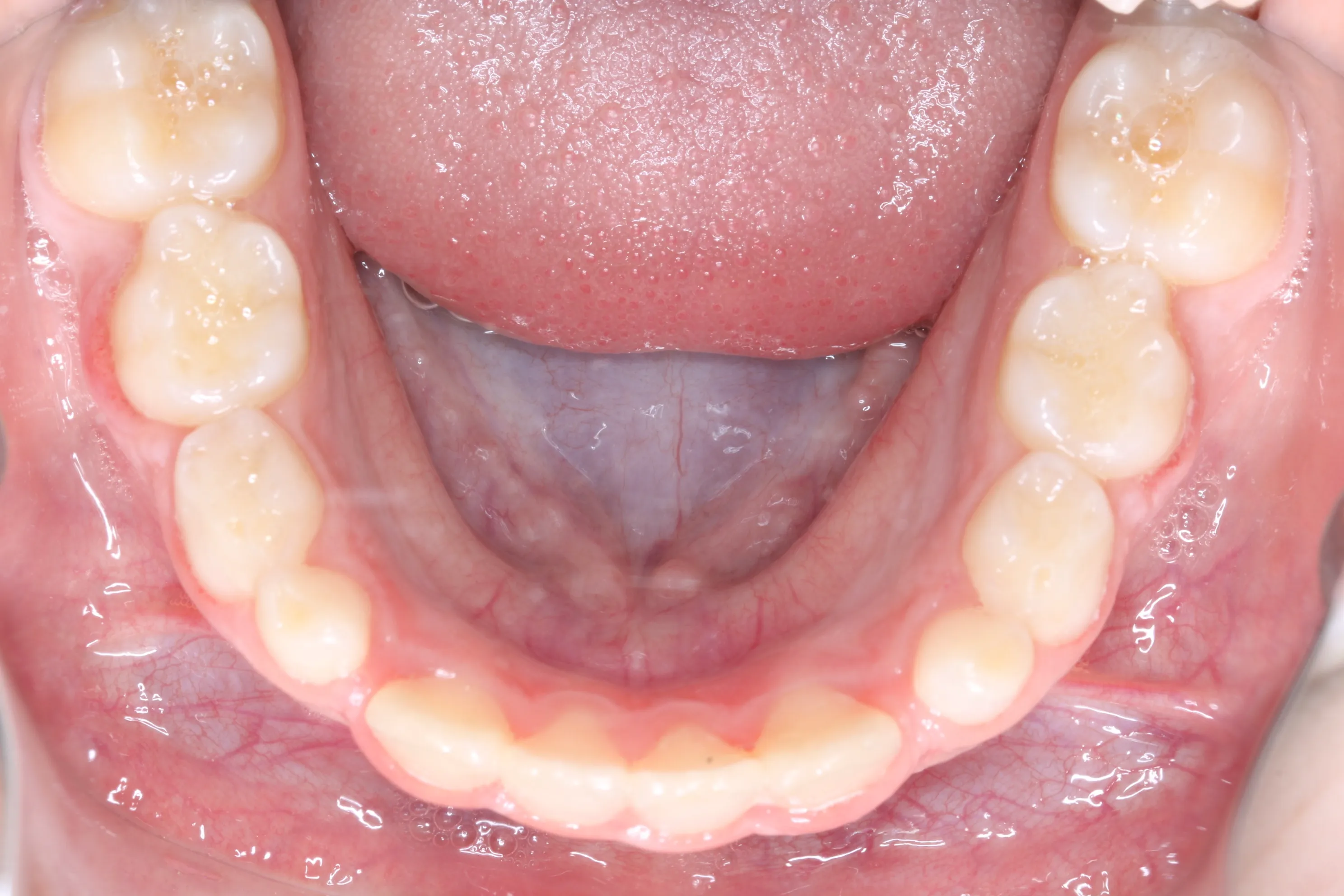 smile-gallery gallery